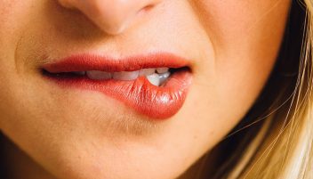 Itchy Gums? You’re Not Alone